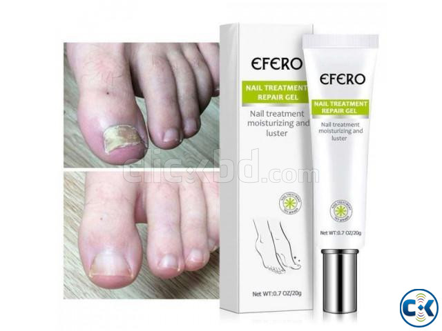 Nail Repair Fungus Treatment Solution Eelhoe Buy 1 Get 1 large image 1