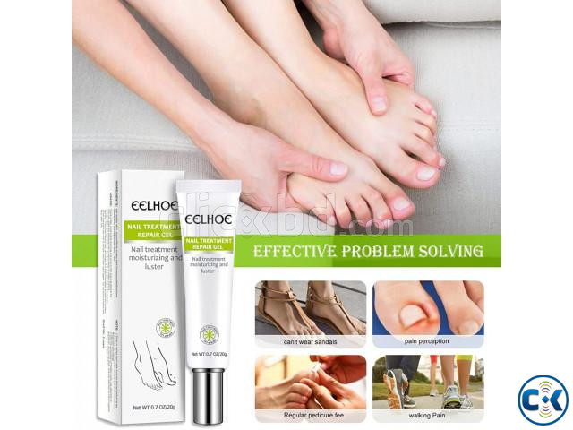 Nail Repair Fungus Treatment Solution Eelhoe Buy 1 Get 1 large image 2