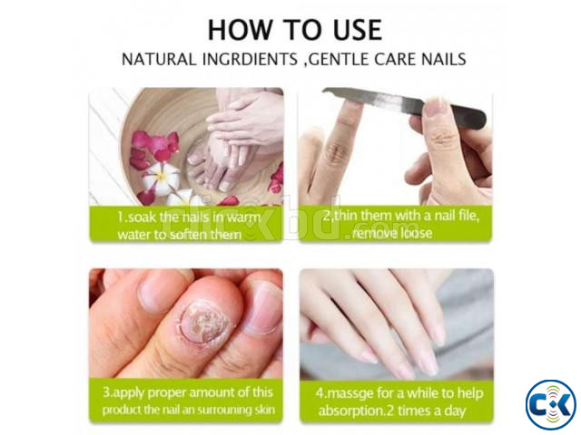 Nail Repair Fungus Treatment Solution Eelhoe Buy 1 Get 1 large image 3