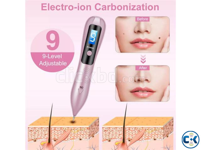 Skin Tag Remover Plasma Pen large image 2