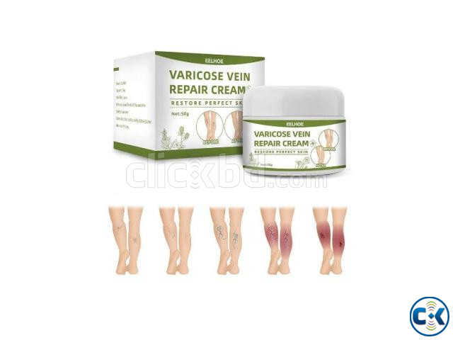 Varicose Veins Cream large image 0