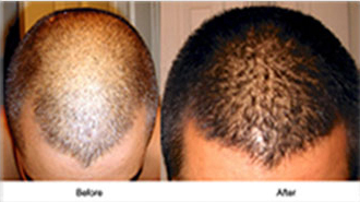 Hair Building Fiber large image 0