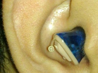 Widex Hearing Aid